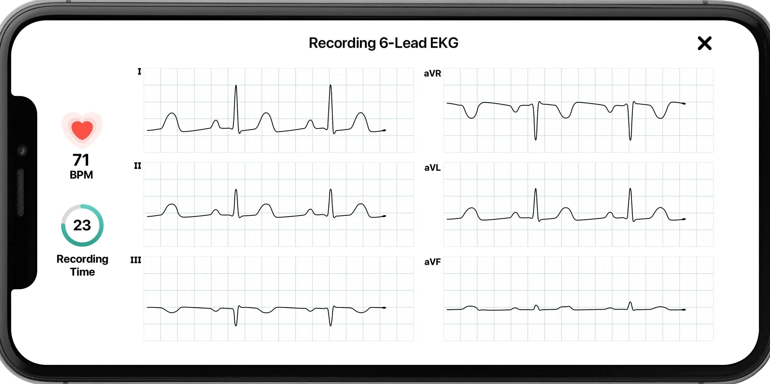 AliveCor KardiaMobile 6L Personal EKG Monitor, Black - KM-6L-E - Image 5
