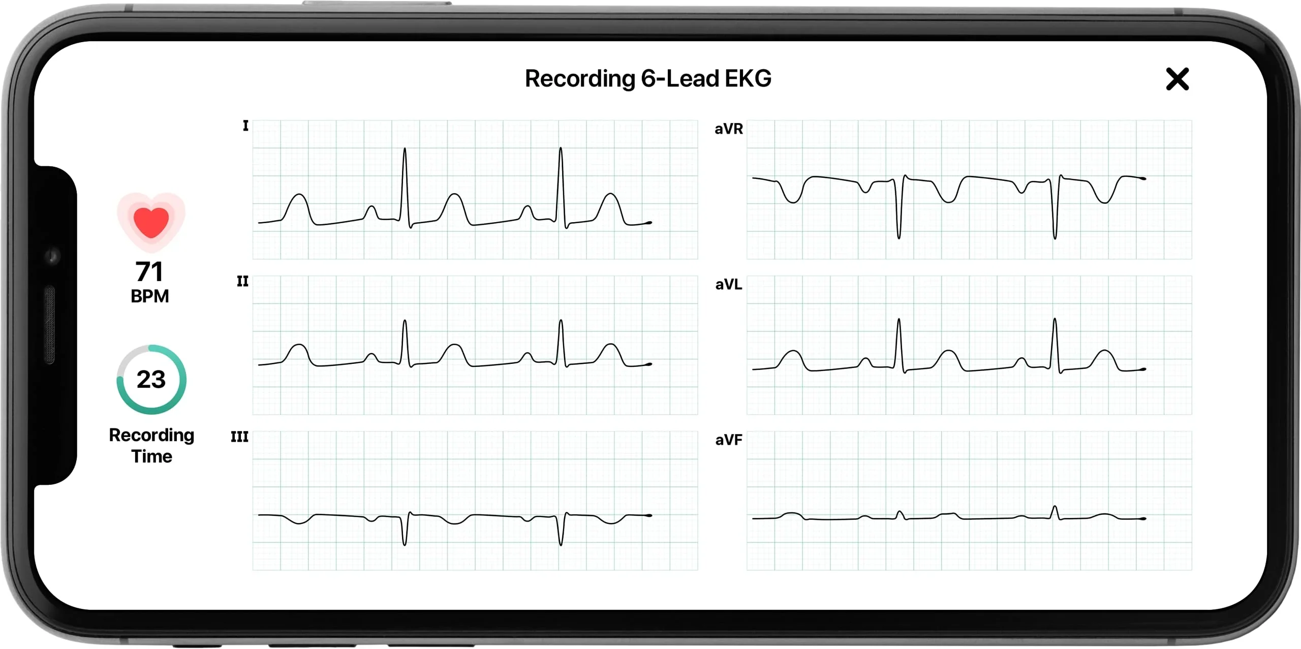 AliveCor KardiaMobile 6L Personal EKG Monitor, Black - KM-6L-E - Image 4
