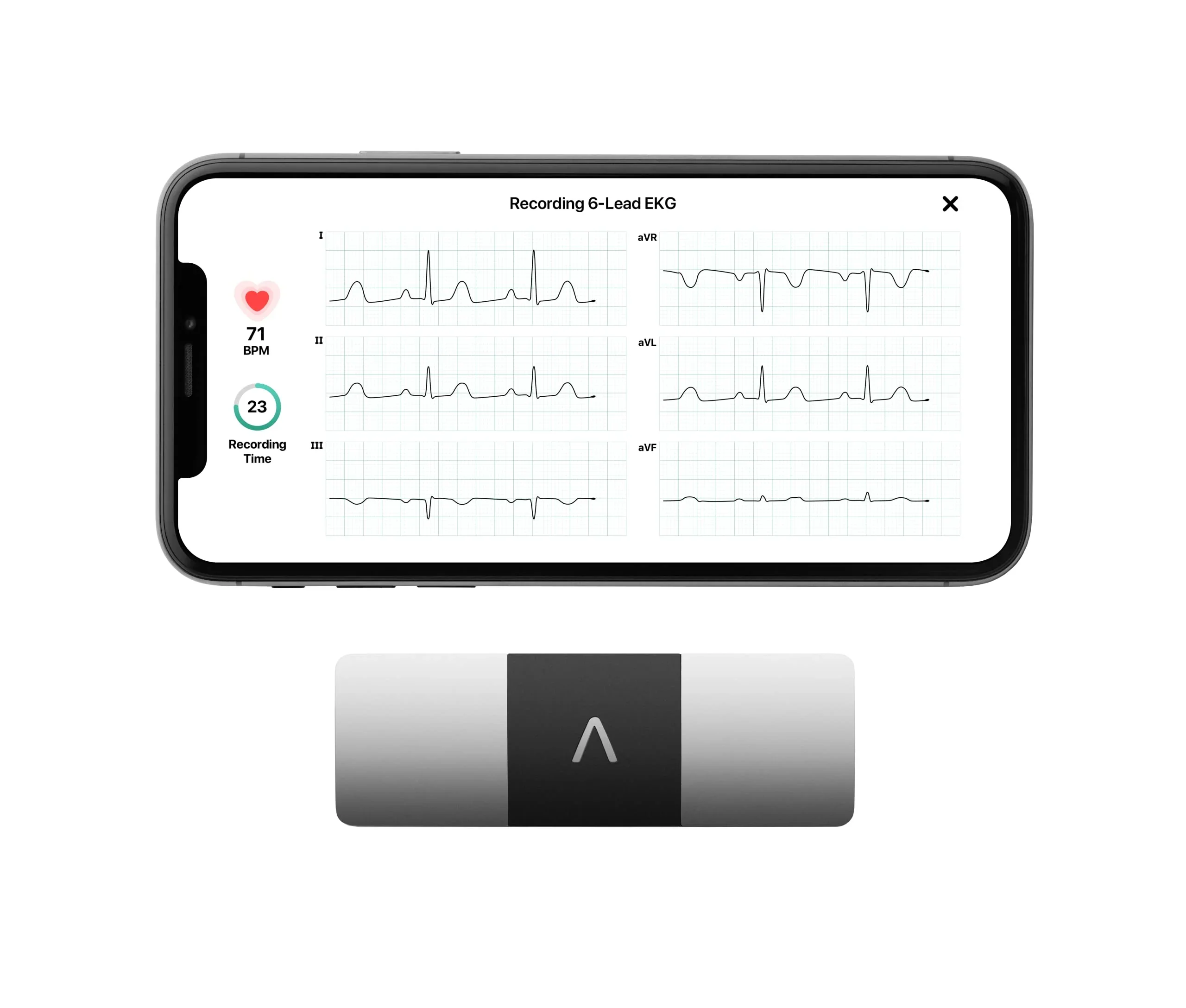 AliveCor KardiaMobile 6L Personal EKG Monitor, Black - KM-6L-E