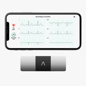 AliveCor KardiaMobile 6L Personal EKG Monitor, Black - KM-6L-E
