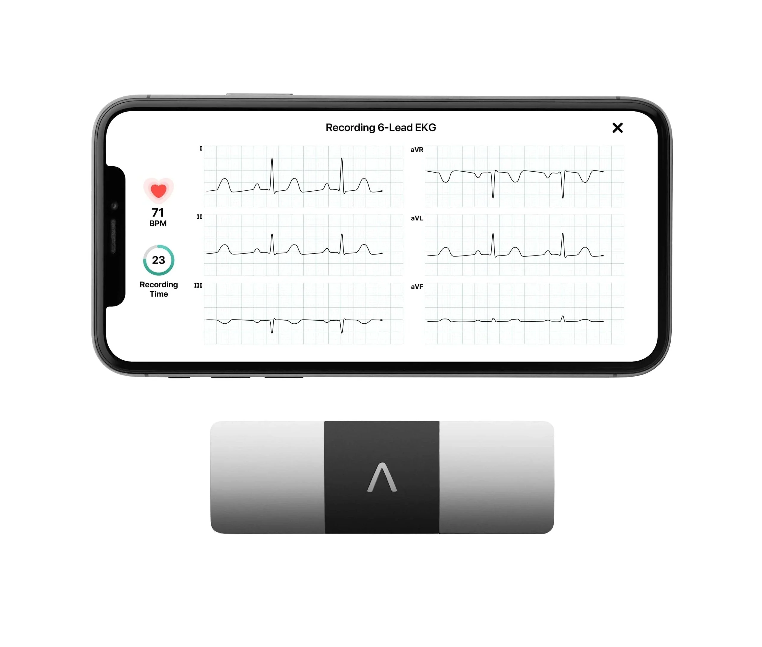 AliveCor KardiaMobile 6L Personal EKG Monitor, Black - KM-6L-E - Image 2